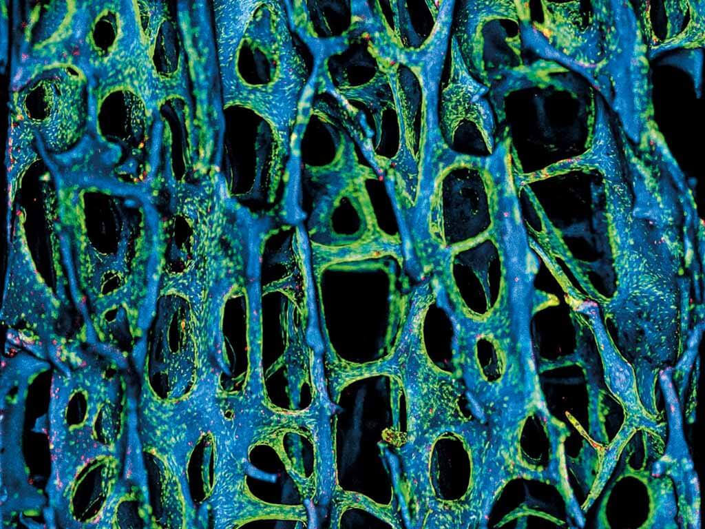 Регенерация костной ткани: этапы, материалы и сигнальные молекулы